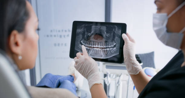 Licensed Tooth Extraction service in Mocksville, NC - Smile Center Dentistry
